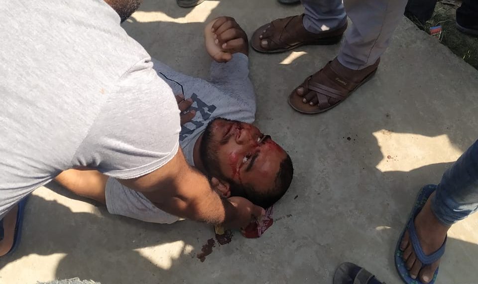 एक्सडवां चौराहे पर मोटरसाइकिल दुर्घटना में एक घायल