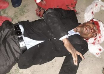 नौतनवां: ट्रक की टक्कर से एक ब्यक्ति बुरी तरह घायल