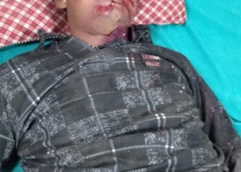 नौतनवां: अनियंत्रित होकर बाइक सवार नाली में गिरा, सर में गंभीर चोट लगने से डॉक्टरों ने किया रेफर