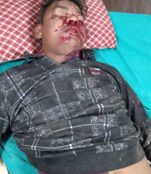 नौतनवां: अनियंत्रित होकर बाइक सवार नाली में गिरा, सर में गंभीर चोट लगने से डॉक्टरों ने किया रेफर