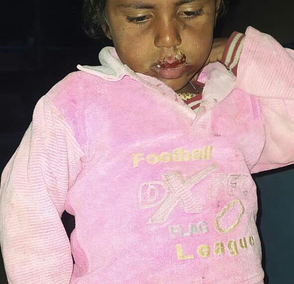 महराजगंज: सड़क पर लावारिस मिली बच्ची, नही बता पा रही अपना पता