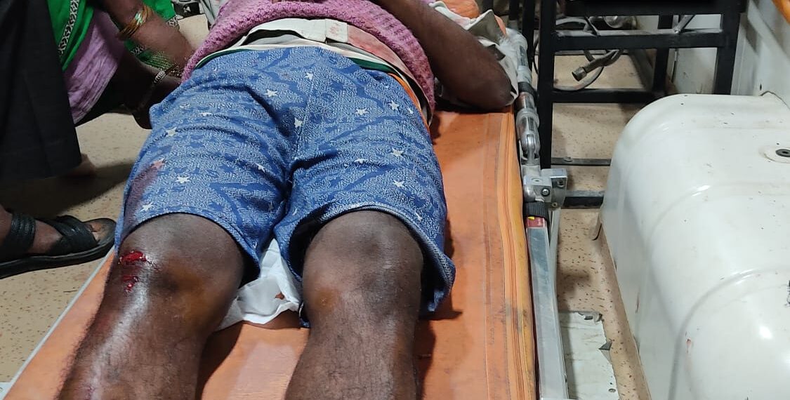 नौतनवां: बाइक चालक ने मारी ठोकर हालत गंभीर, रेफर