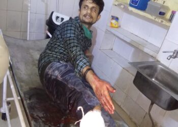 गोरखपुर: 25 हजार का इनामी प्रिंस पांडेय को मुठभेड़ में पैर में लगी गोली, गिरफ्तार