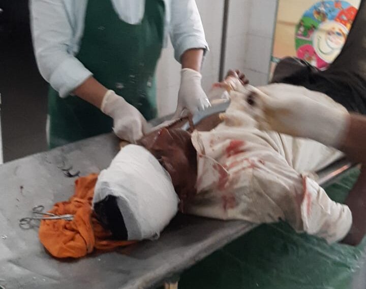 नौतनवां: पुरैनिया चौराहे पर बाइक की चपेट में आने से चौकीदार घायल