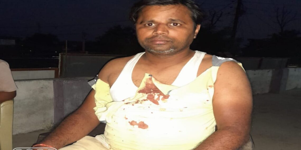 खनुवा: नौतनवां निवासी हरदी-डाली व्यापारी की नेपाल में लाठी डंडे से पिटाई, पुलिस से शिकायत