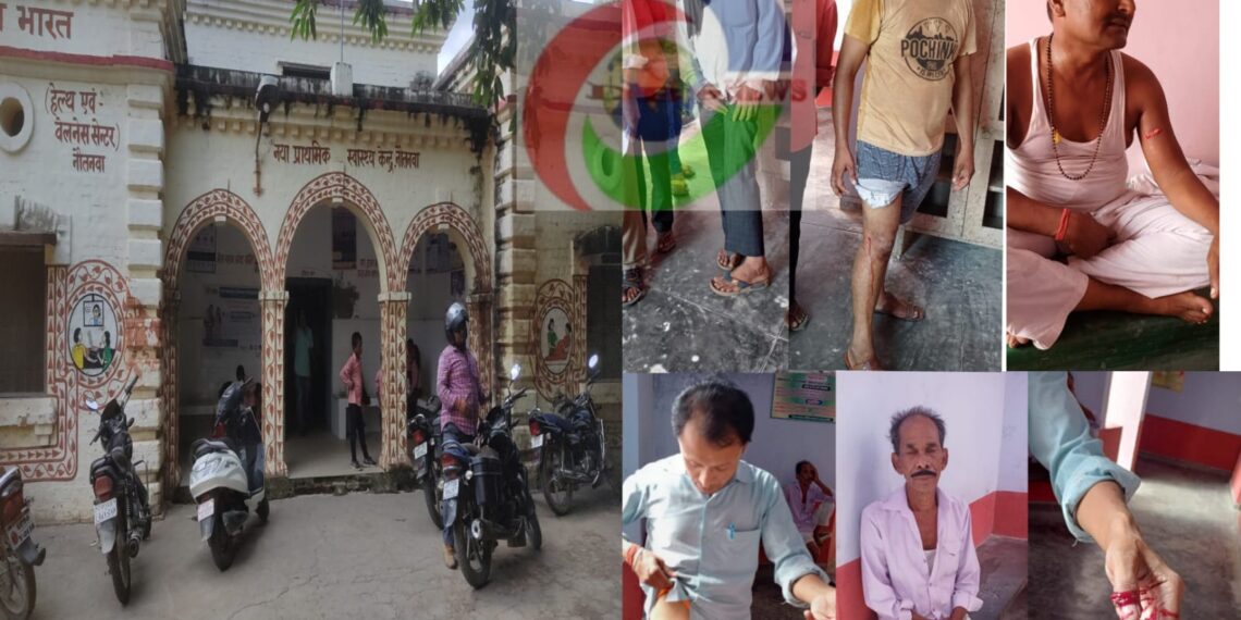 सावधान हो जाये, नौतनवां नगर में एक कुत्ते ने 20 लोगो को काटा