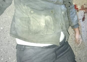 नौतनवां बाईपास पर मार्ग दुर्घटना में 34 वर्षीय युवक बुरी तरह घायल, रेफर