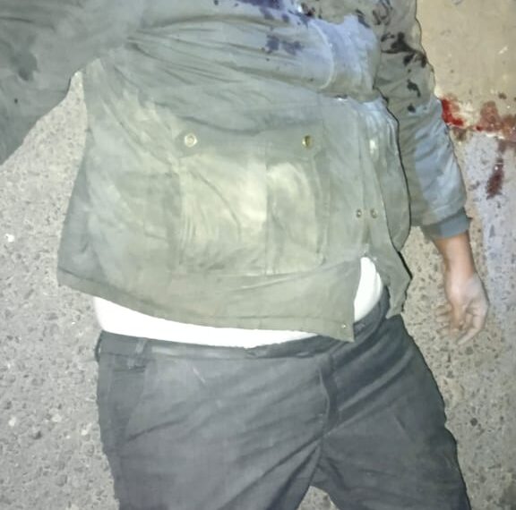 नौतनवां बाईपास पर मार्ग दुर्घटना में 34 वर्षीय युवक बुरी तरह घायल, रेफर