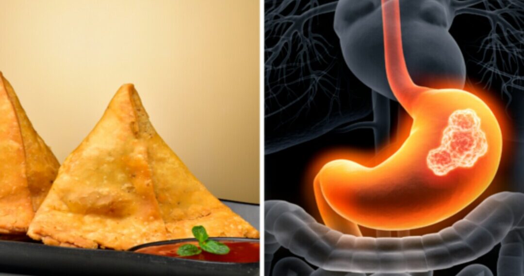 समोसे में ठूसकर भरा आलू बनाता है कैंसर, ये लोग रहें दूर, टेस्ट करना भी है जहर